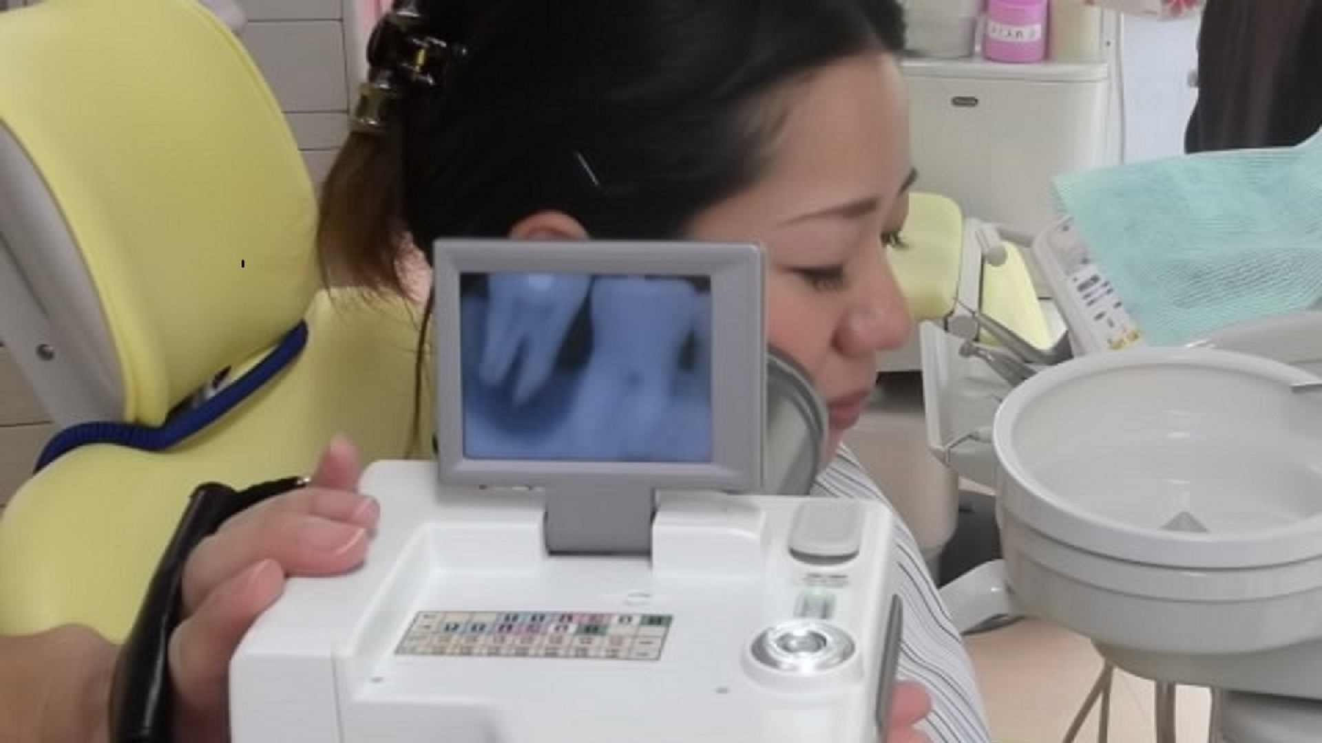 携行用レントゲン